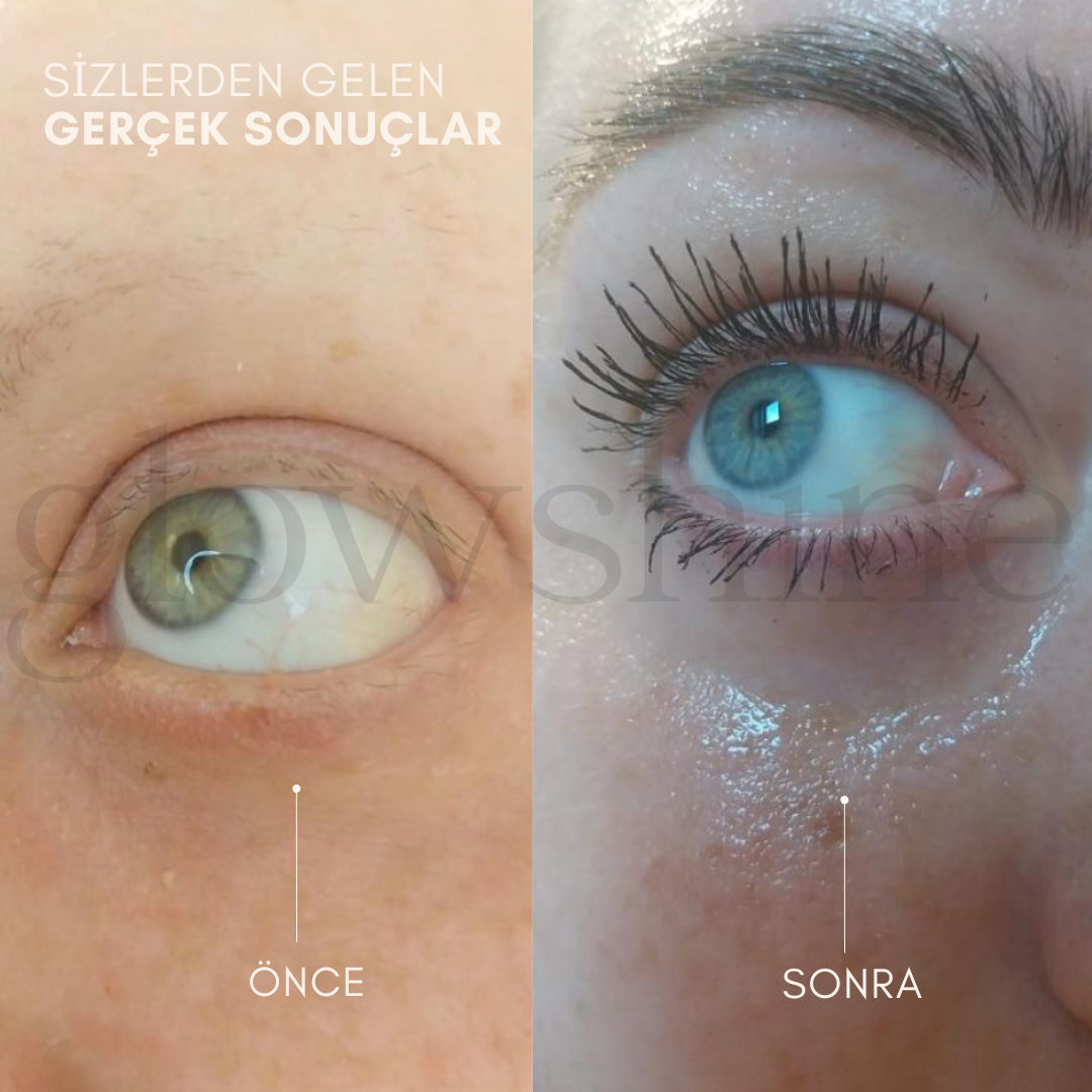 GLOWSHİNE Besleyici Kirpik Serumu